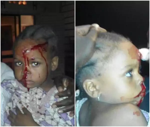 Stray Bullet Hit 4years Old Girl At The four-Head  As Boko Haram Militants Infiltrate Borno (Graphic Photos)